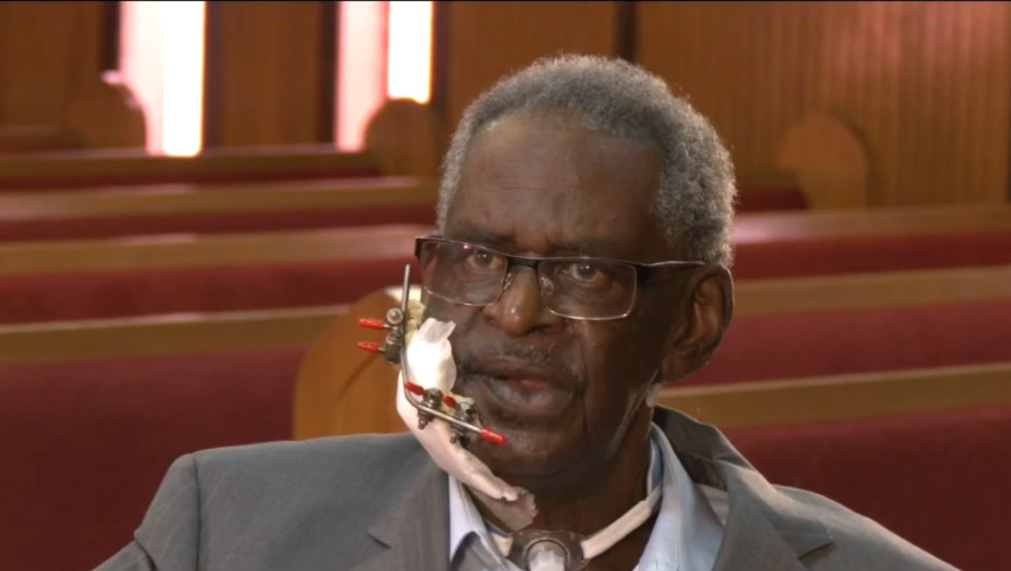 Pastor shot in face speaks out after suspect's charges dropped