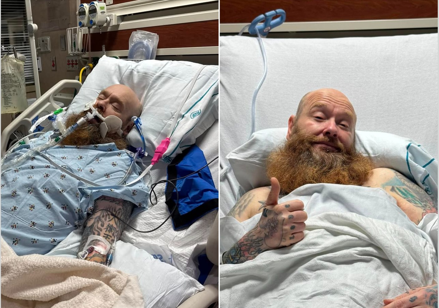 Todd Bentley recovers from 10-hour coma caused by stress