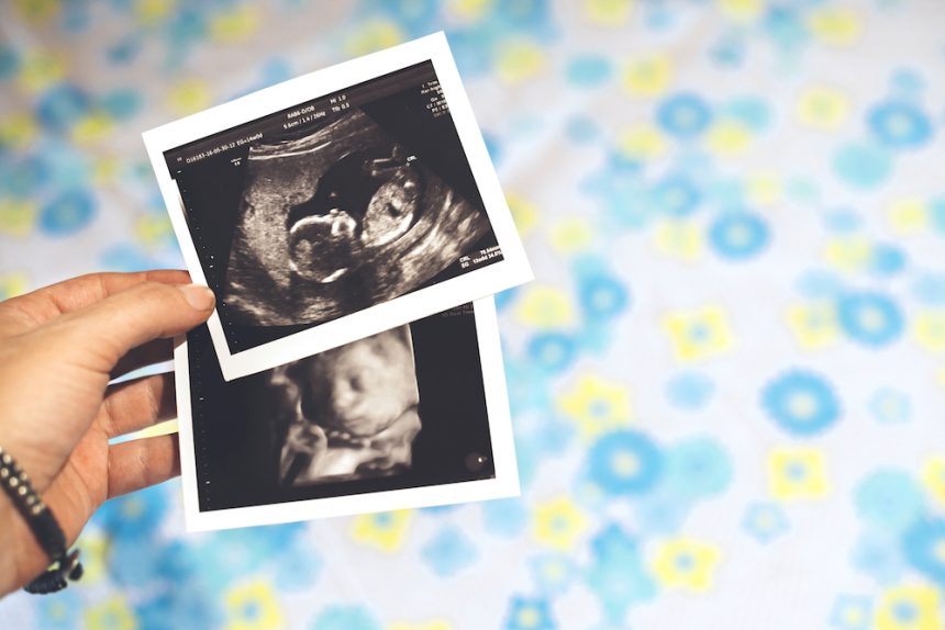 Do aborted babies go to Heaven or Hell?